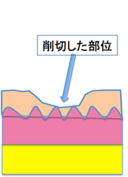 削切した部位